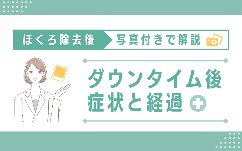 ほくろ除去後のダウンタイム症状と経過を写真付きで紹介！